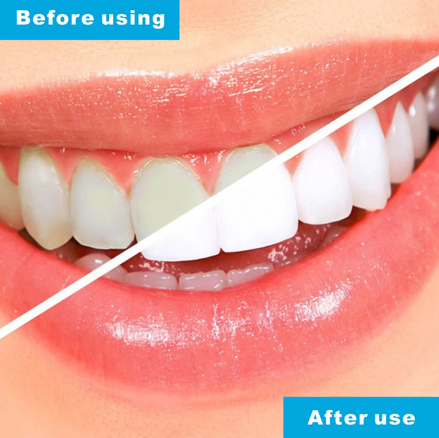 Sleep Aid Mouth Guard Anti Snoring & Grinding Shield